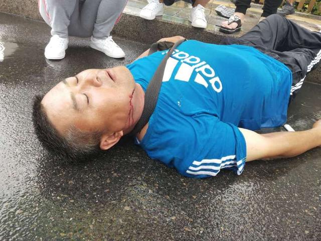 图为2018年8月18日,山东滨州细雨纷飞,一男子酒后骑电车摔倒,昏迷不醒